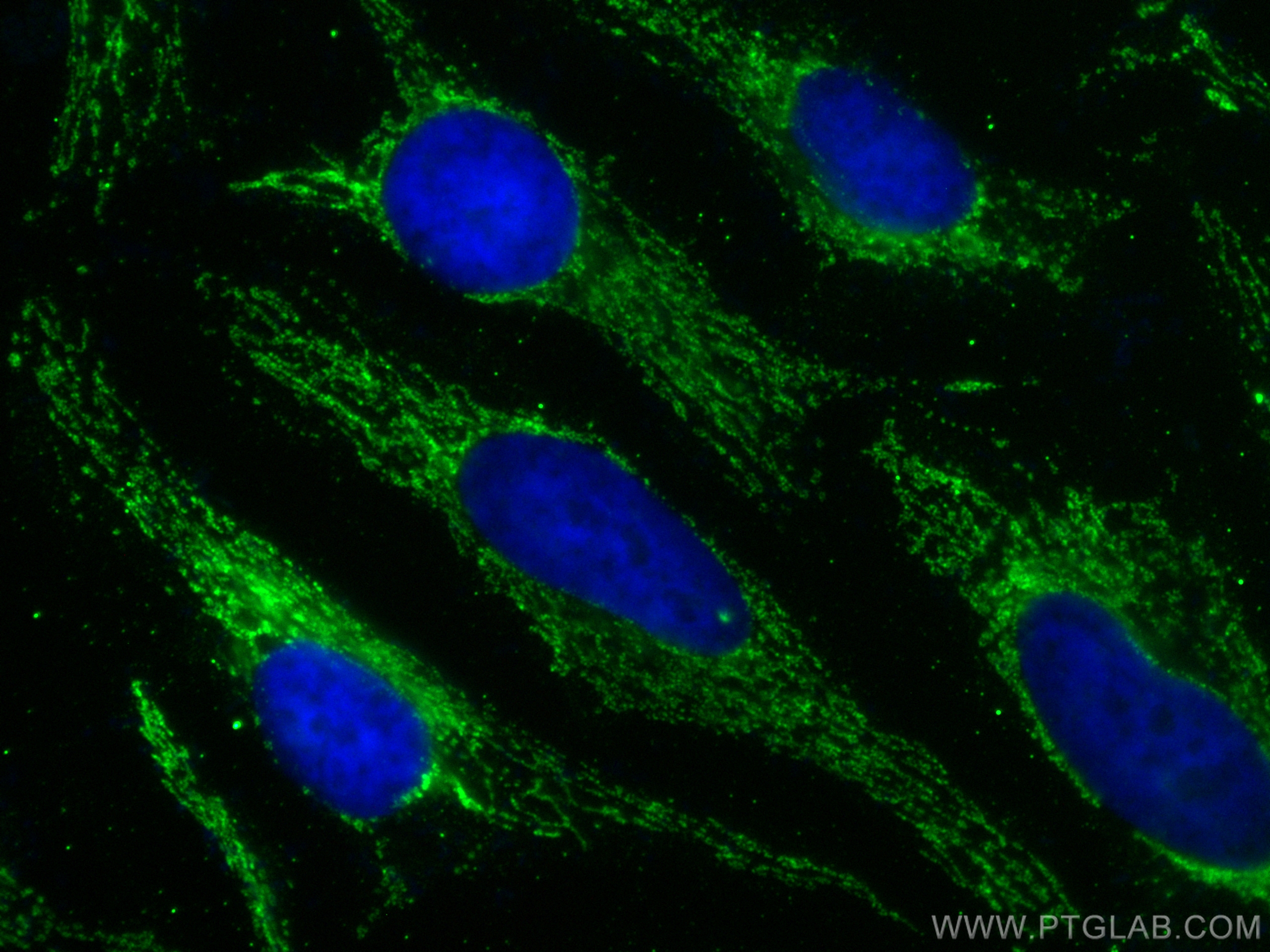 IF Staining of HeLa using 68623-1-Ig