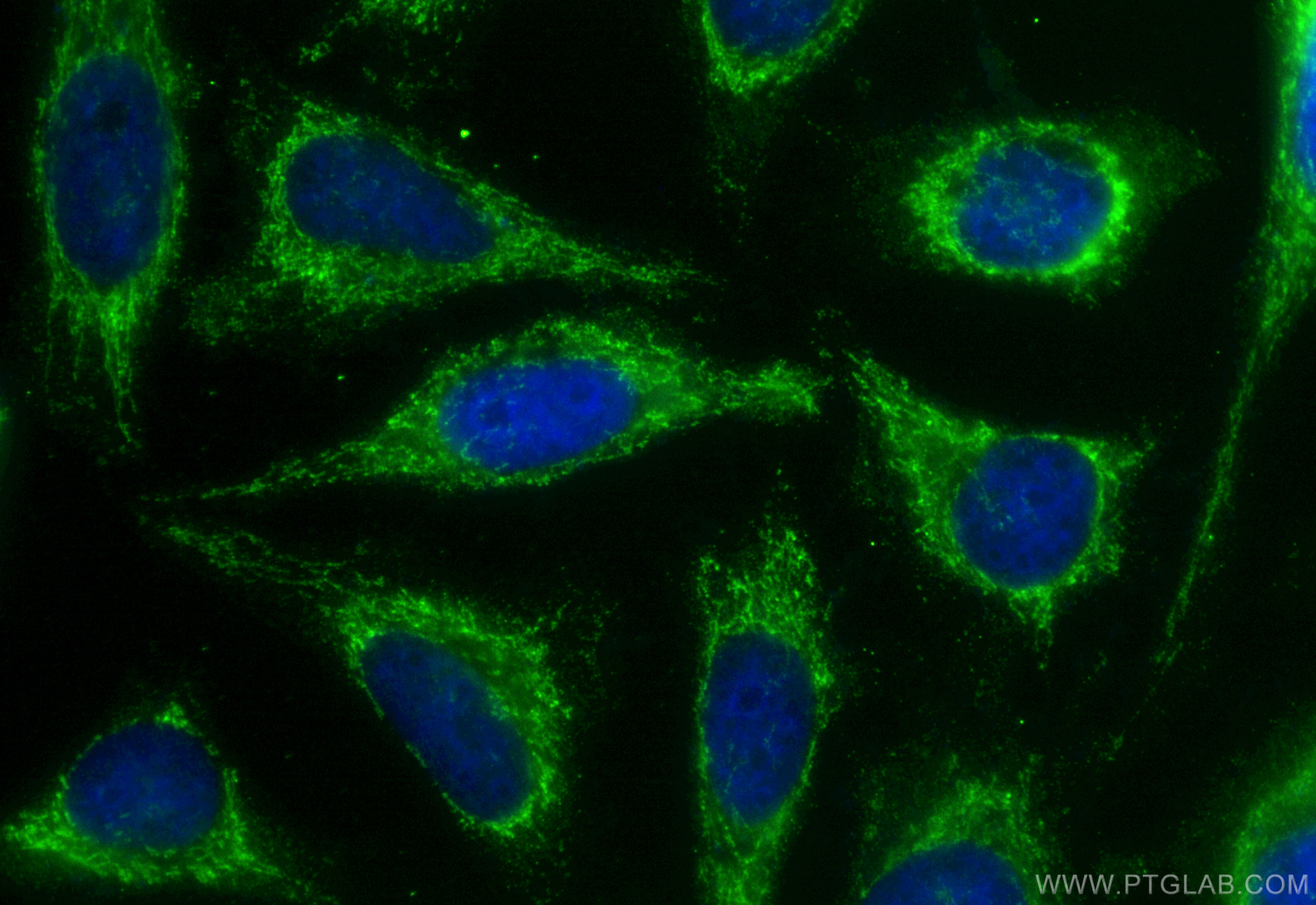 IF Staining of HeLa using CL488-68623