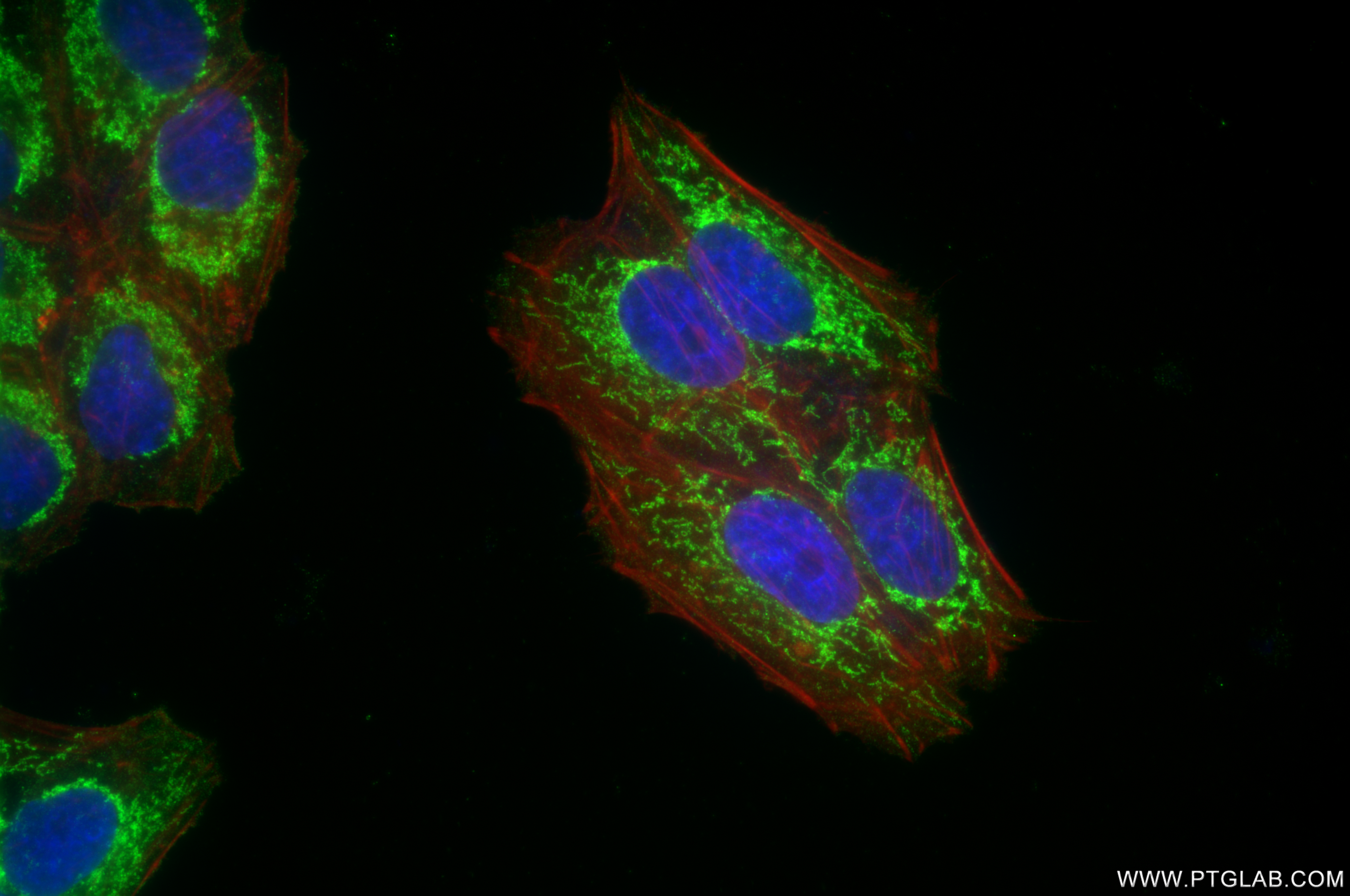 IF Staining of HepG2 using 85109-4-RR (same clone as 85109-4-PBS)