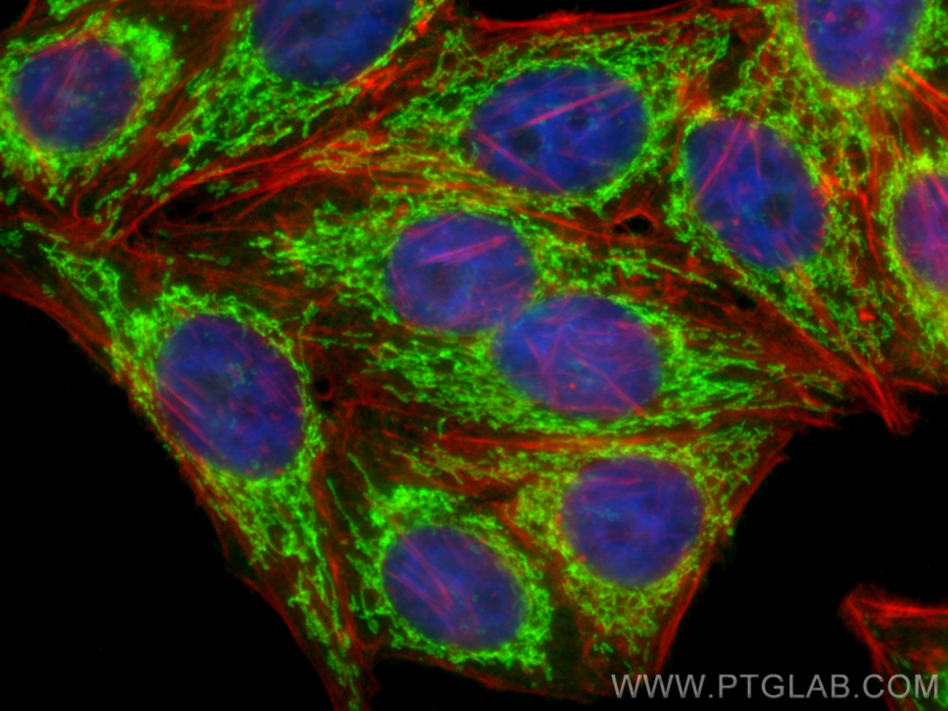 IF Staining of HepG2 using 14795-1-AP