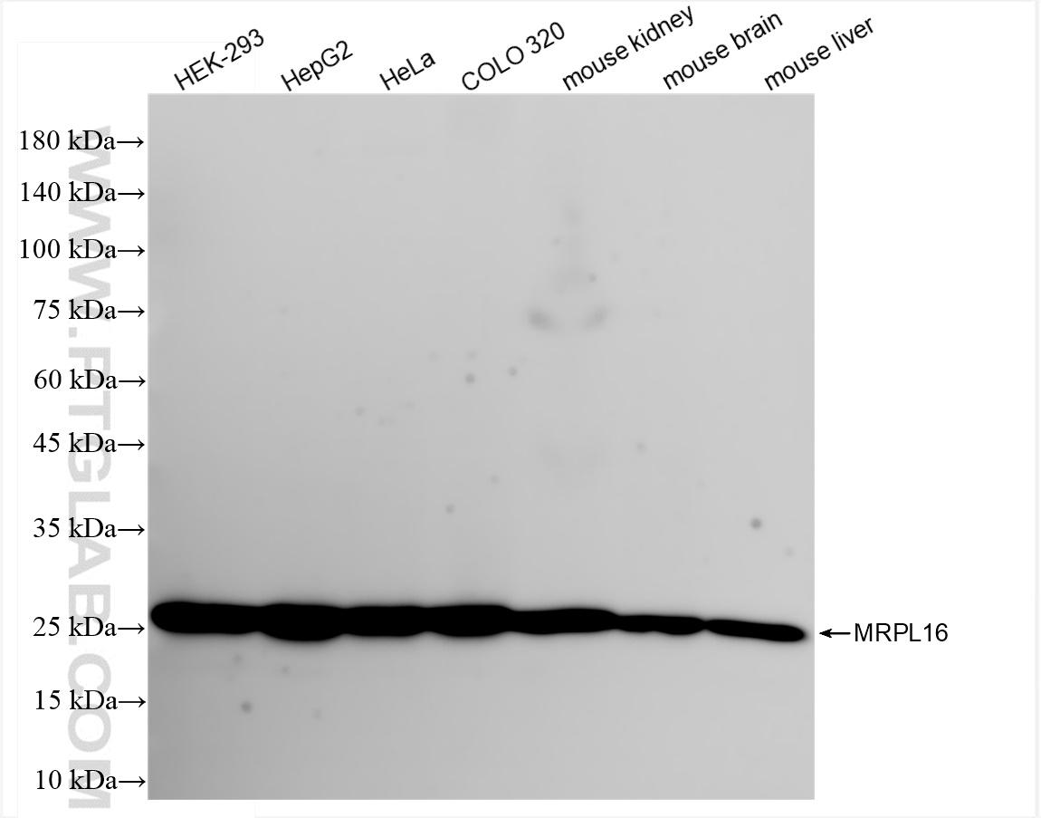 WB analysis using 83888-1-RR (same clone as 83888-1-PBS)