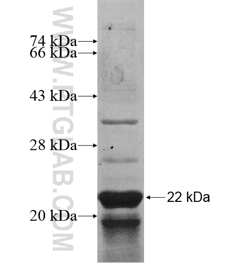 MRPL17 fusion protein Ag11232 SDS-PAGE MRPL17 fusion protein Ag11232 SDS-PAGE