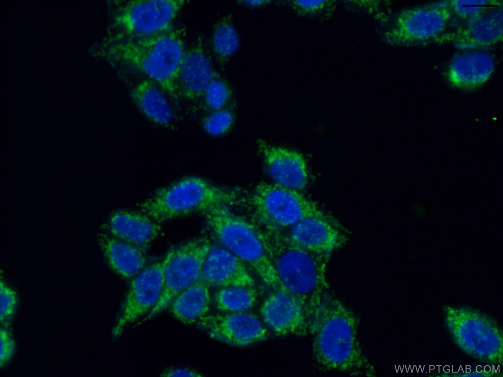 IF Staining of HeLa using 16517-1-AP