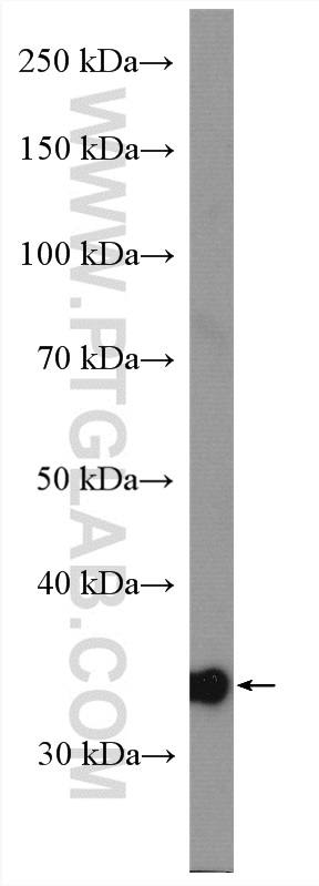 WB analysis of mouse kidney using 16517-1-AP