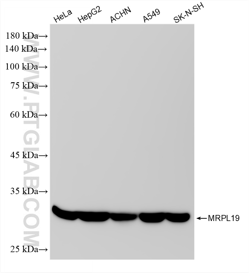 WB analysis using 87422-1-RR (same clone as 87422-1-PBS) WB analysis using 87422-1-RR (same clone as 87422-1-PBS)