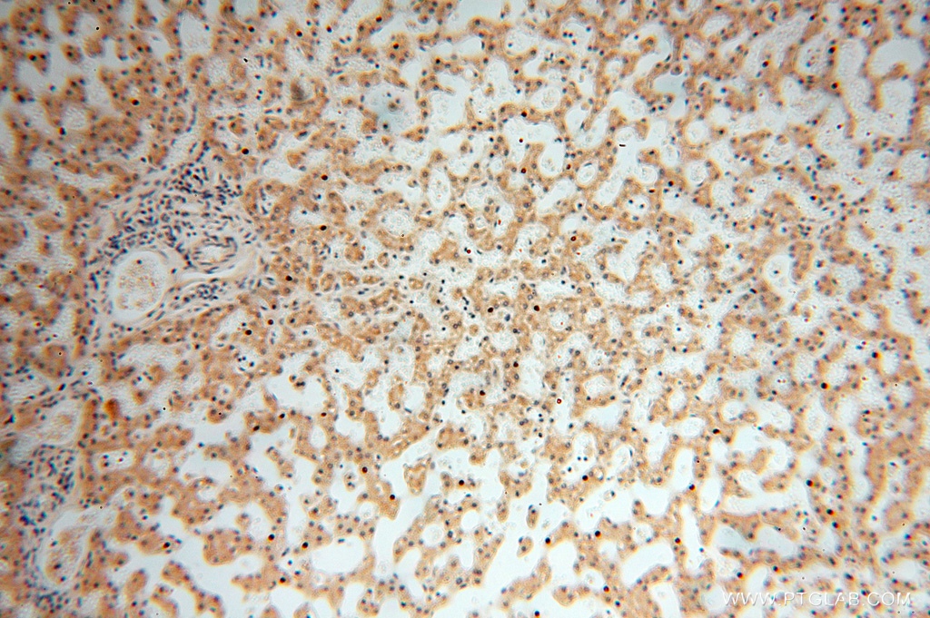 IHC staining of human liver using 16978-1-AP
