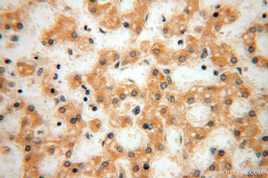 IHC staining of human liver using 16978-1-AP