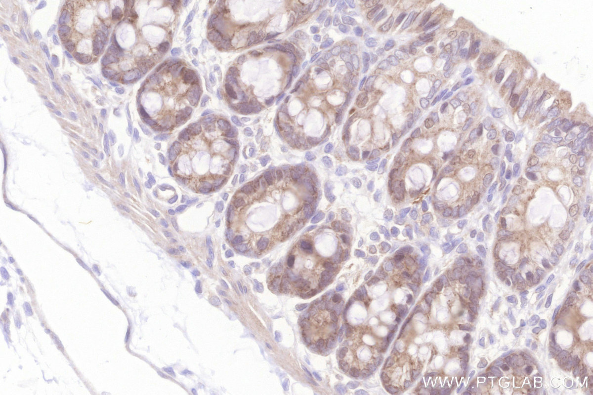IHC staining of rat colon using 66595-1-Ig
