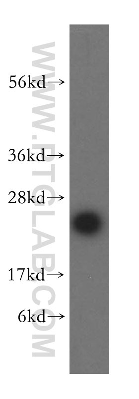 MRPL24 Polyclonal antibody