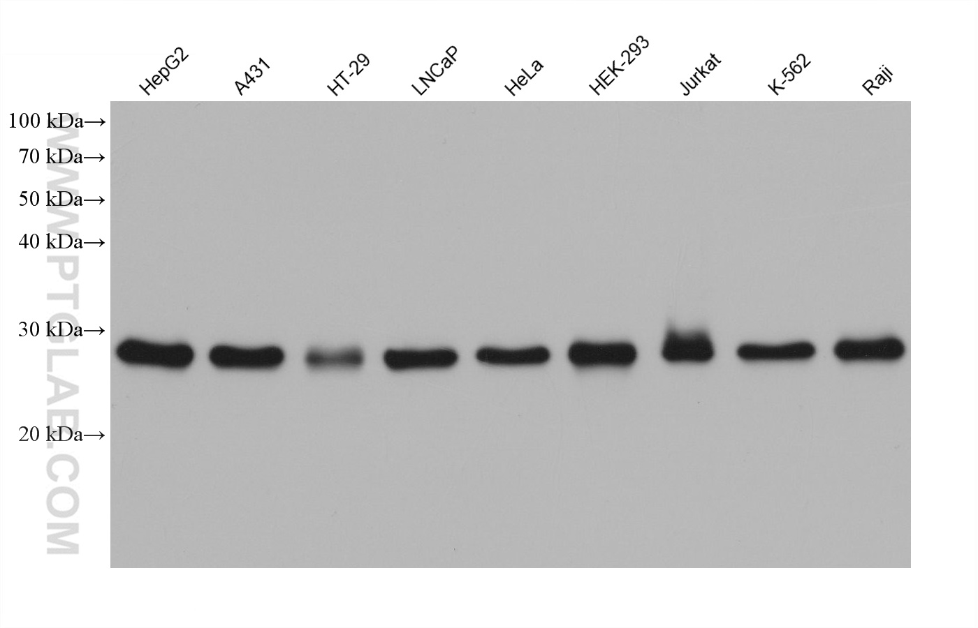 WB analysis using 68556-1-Ig