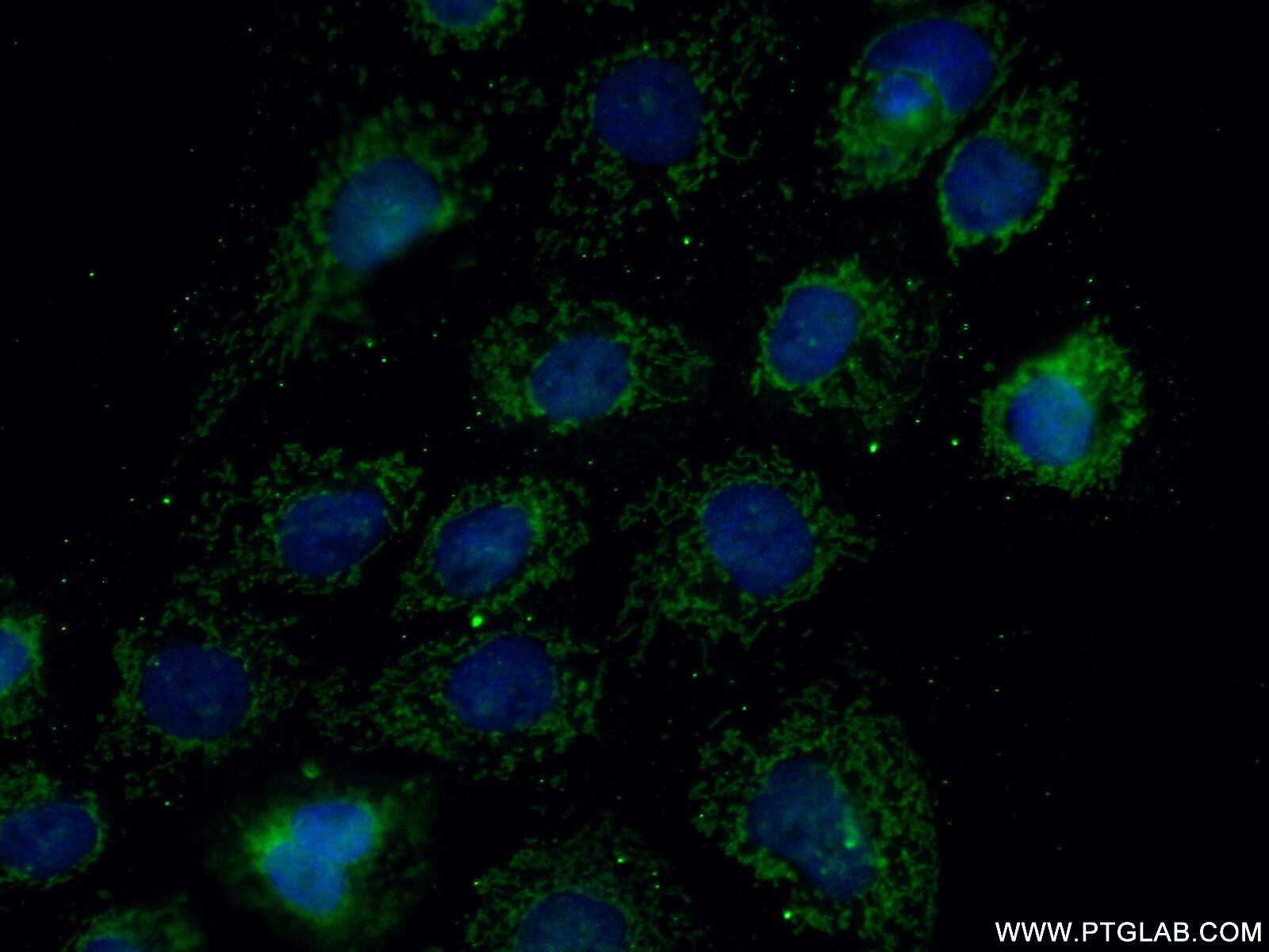 IF Staining of A431 using 14765-1-AP