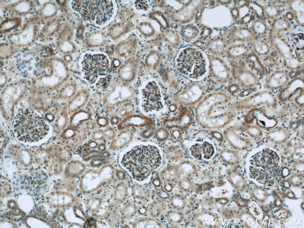 IHC staining of human kidney using 21604-1-AP