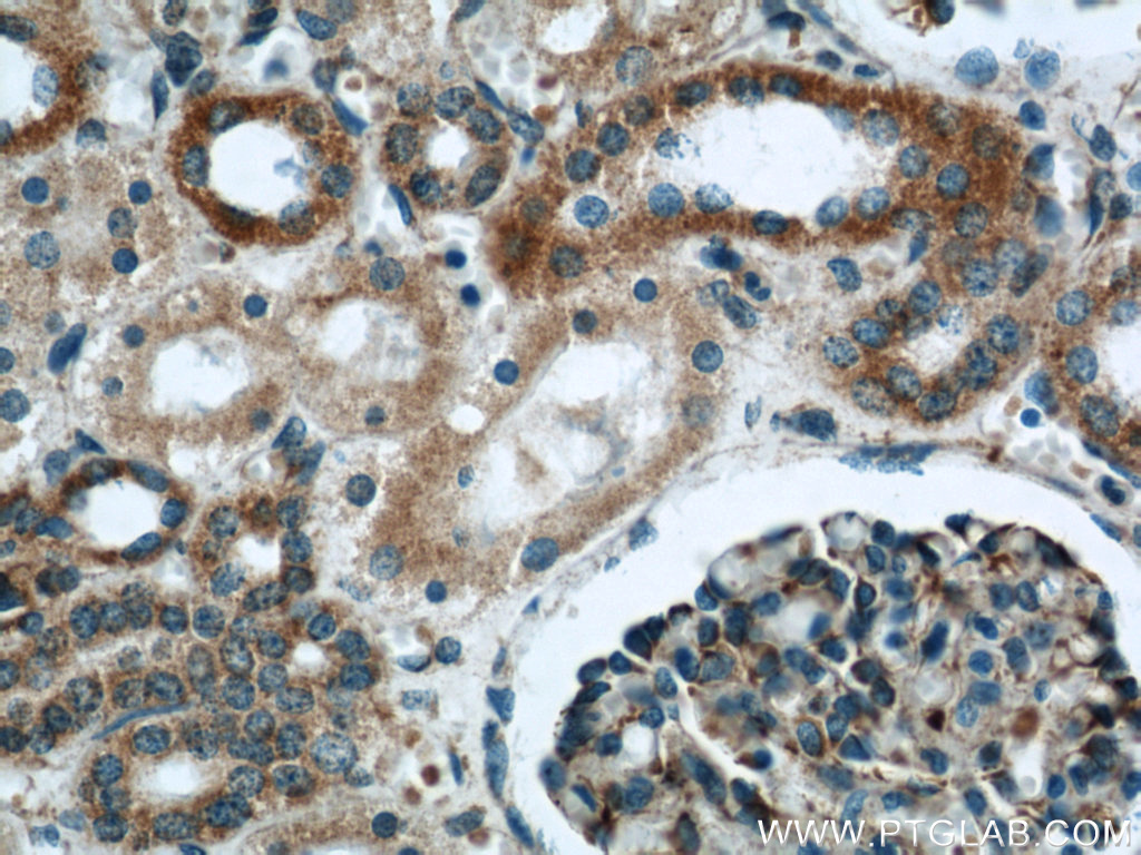 IHC staining of human kidney using 21604-1-AP