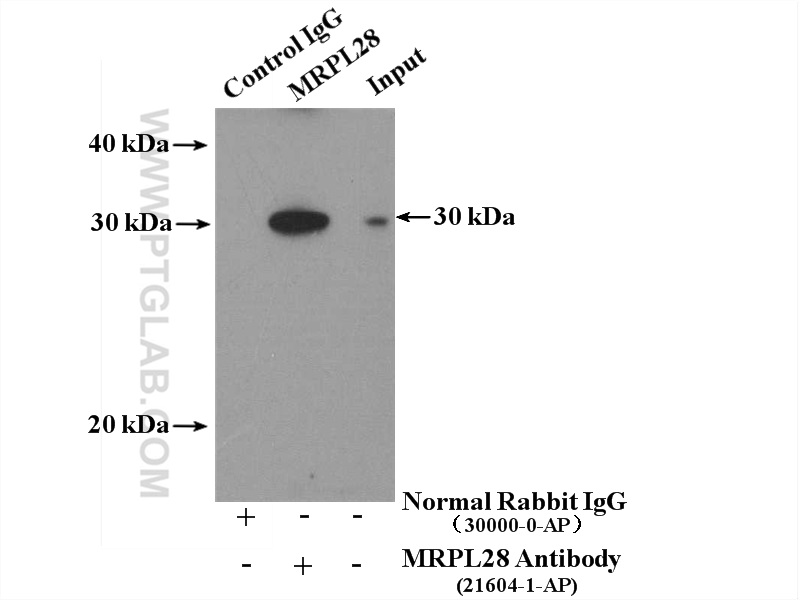 IP experiment of mouse brain using 21604-1-AP