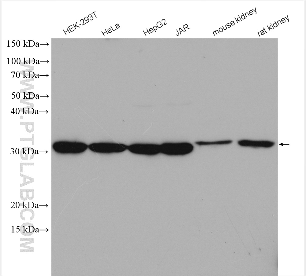 WB analysis using 21604-1-AP