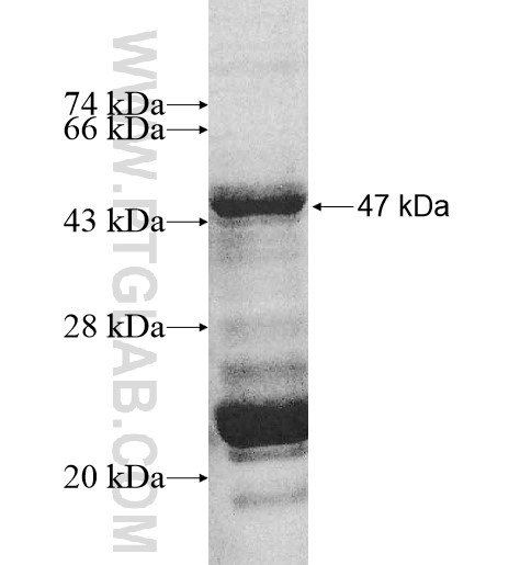 MRPL32 fusion protein Ag10775 SDS-PAGE MRPL32 fusion protein Ag10775 SDS-PAGE