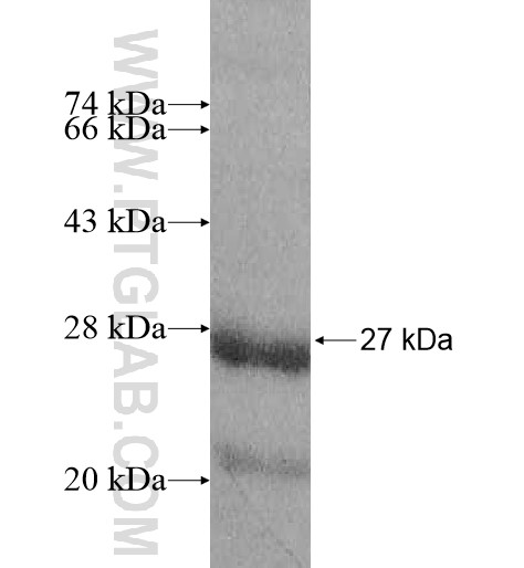 MRPL32 fusion protein Ag10946 SDS-PAGE MRPL32 fusion protein Ag10946 SDS-PAGE
