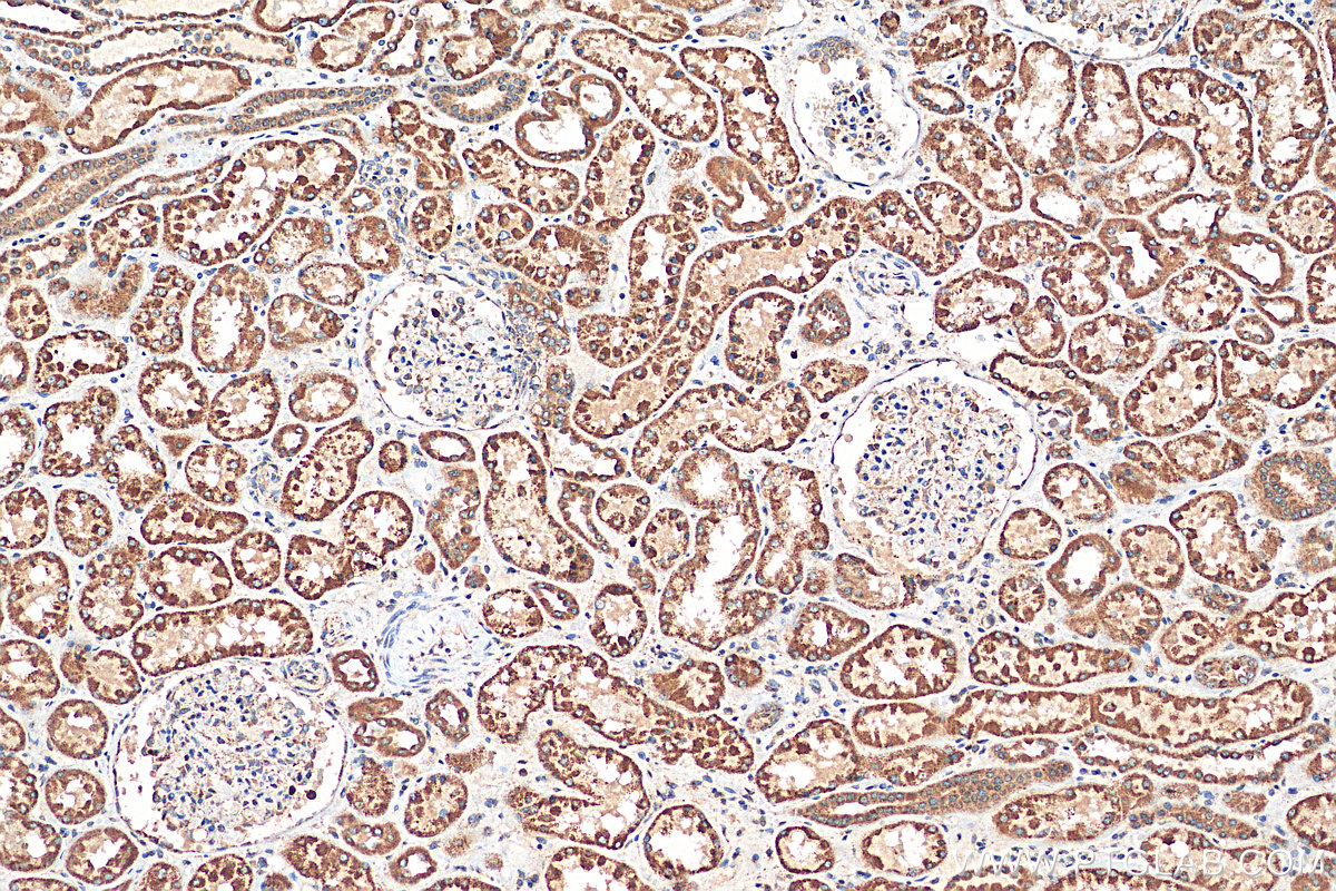 IHC staining of human kidney using 23870-1-AP (same clone as 23870-1-PBS)