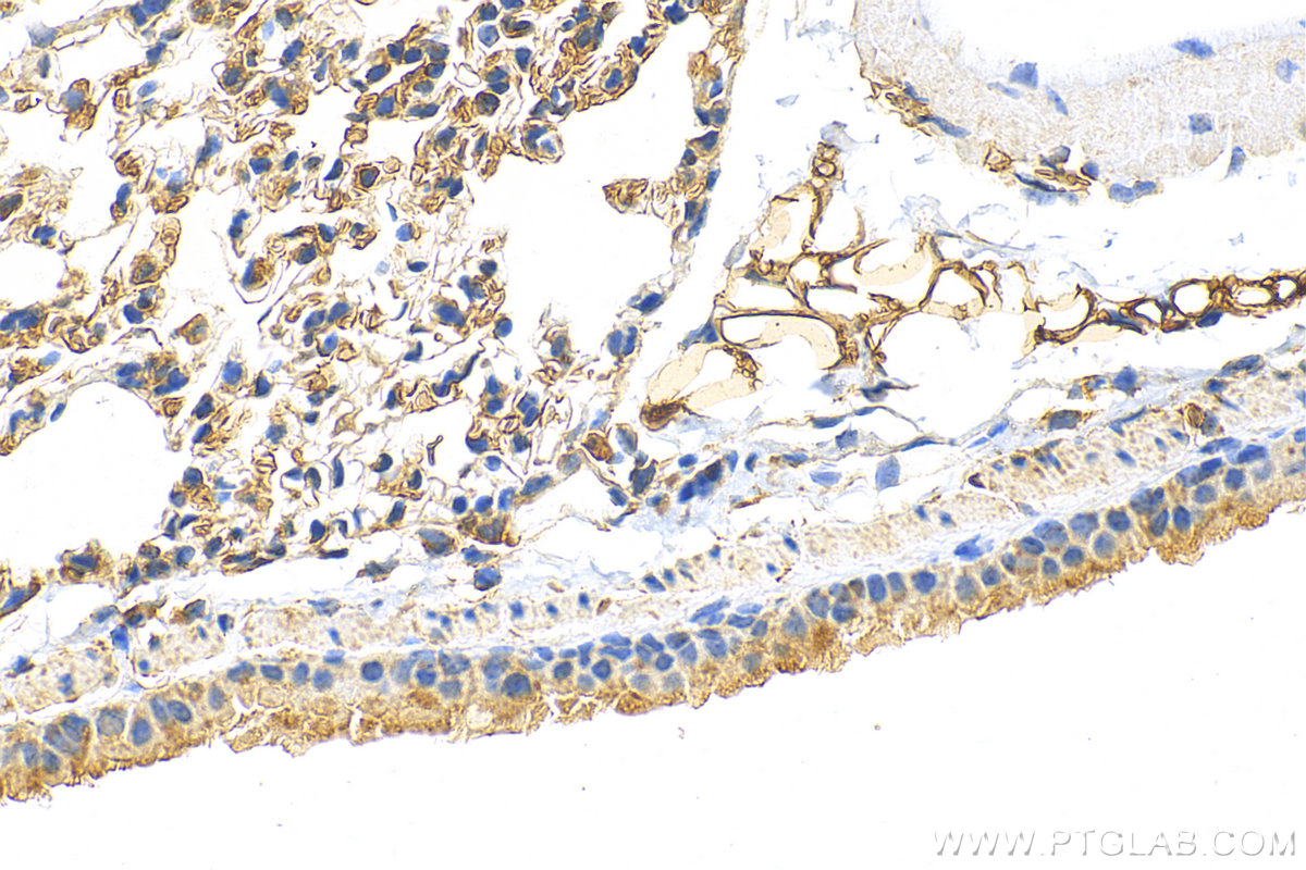 IHC staining of mouse lung using 15233-1-AP