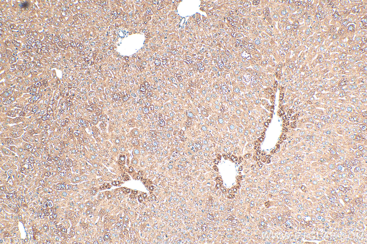 IHC staining of mouse liver using 27339-1-AP