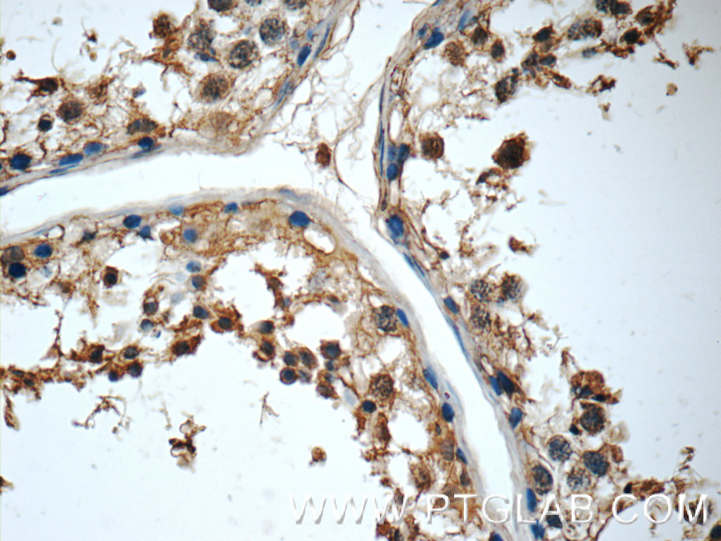 IHC staining of human testis using 16625-1-AP