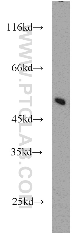 MRPL37 Polyclonal antibody