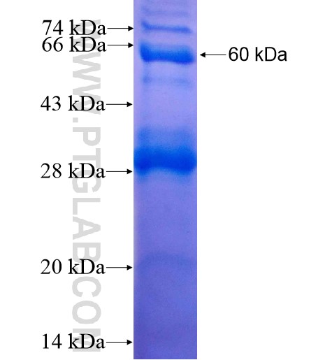 MRPL37 fusion protein Ag7276 SDS-PAGE