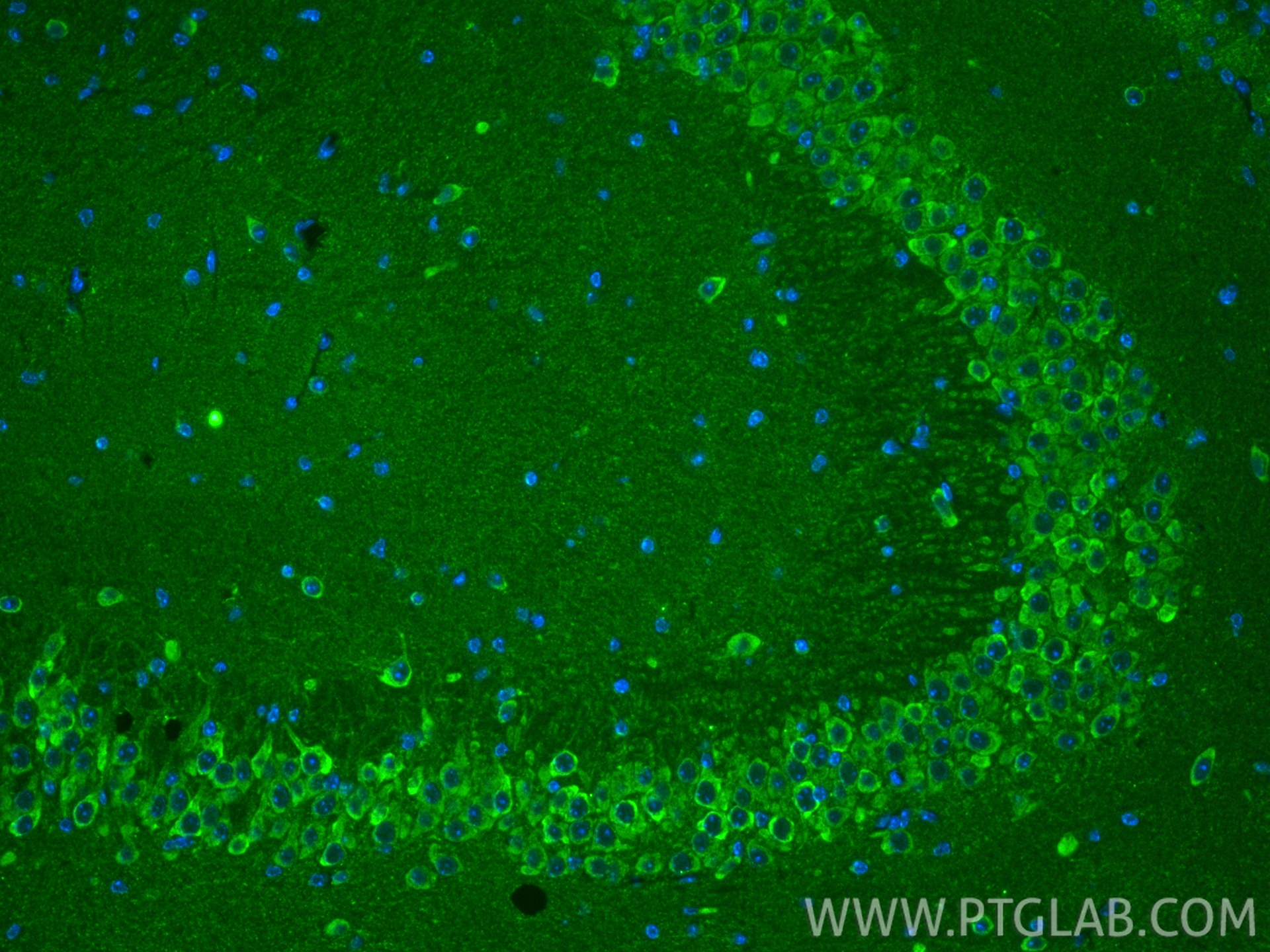 IF Staining of mouse brain using 15913-1-AP