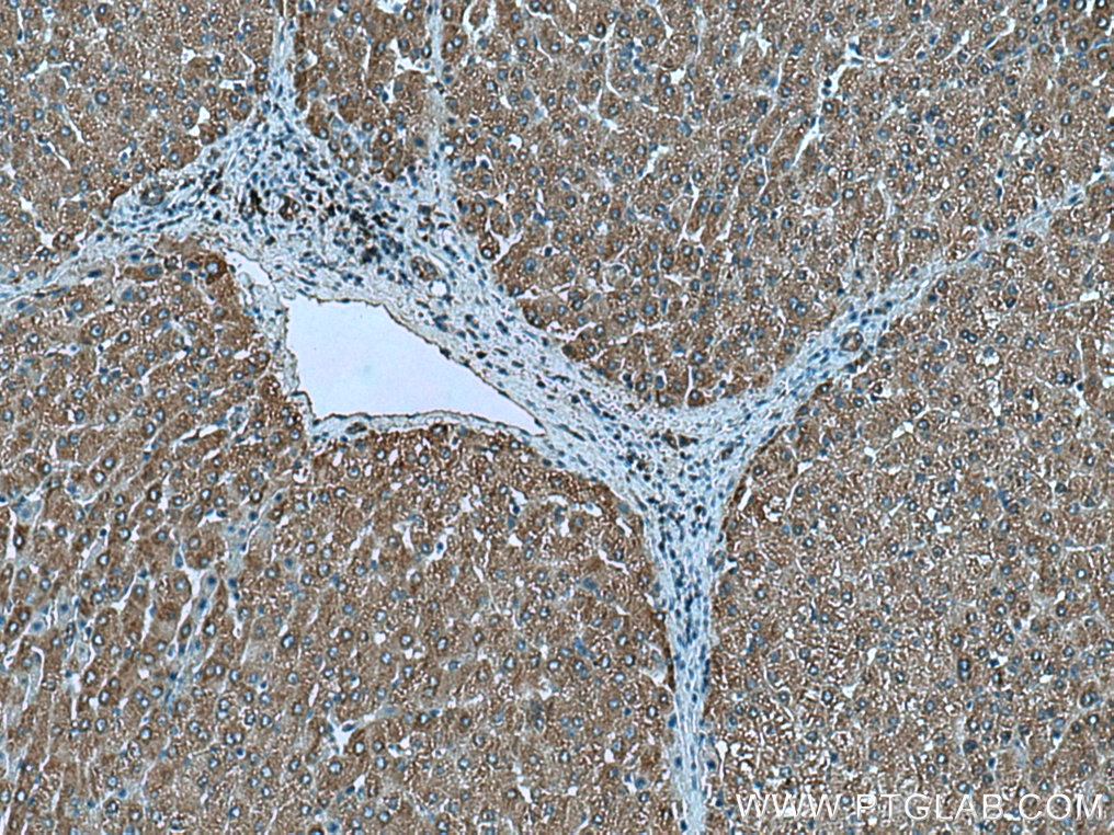 IHC staining of human liver using 15913-1-AP