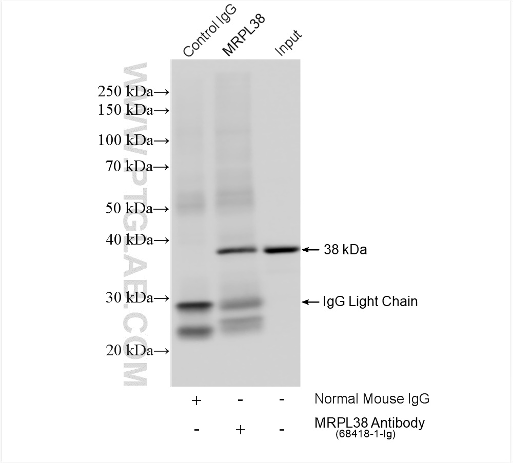 IP experiment of A549 using 68418-1-Ig