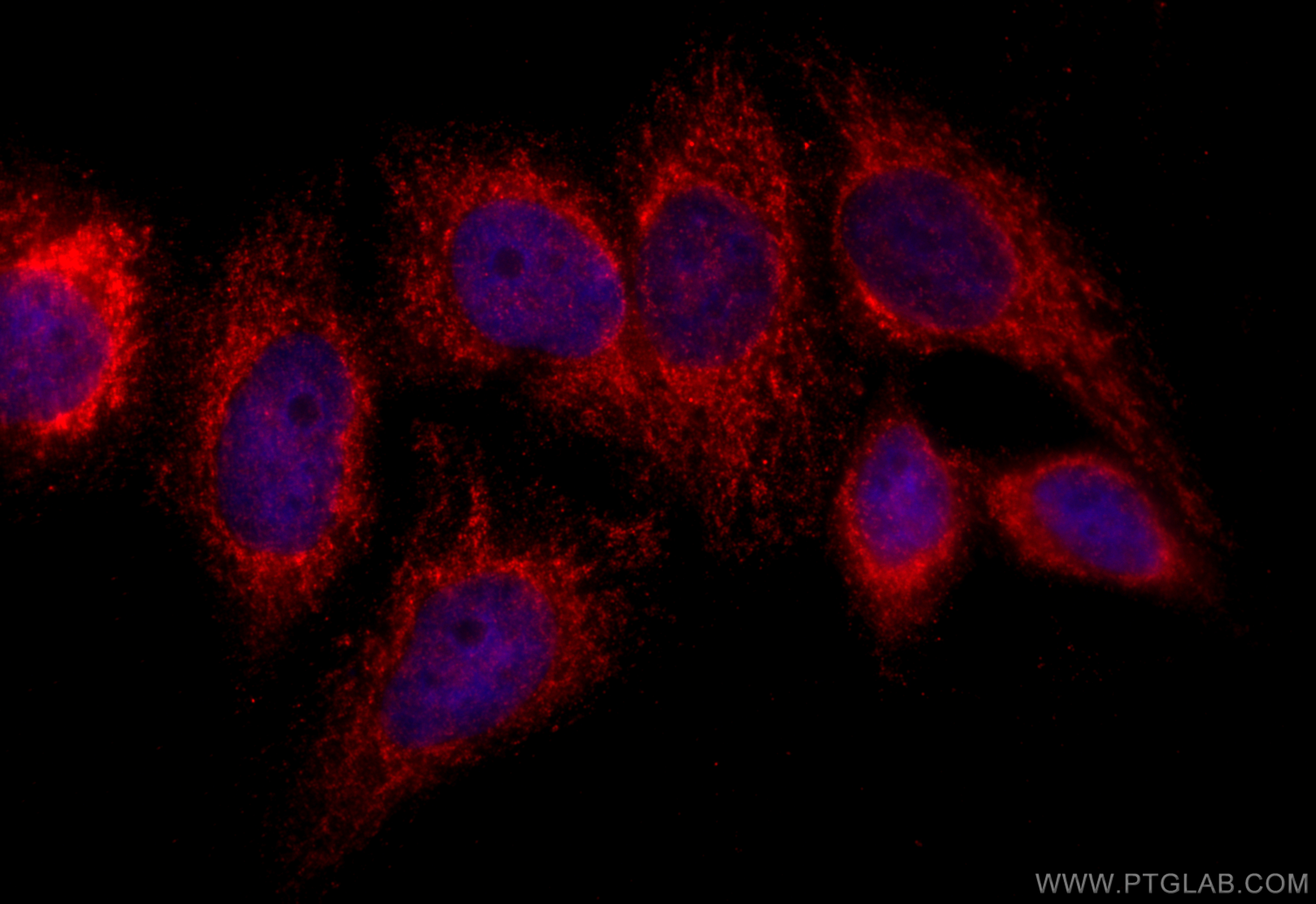 IF Staining of HepG2 using 28165-1-AP
