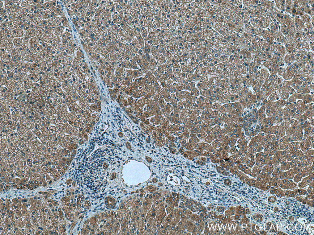 IHC staining of human liver using 28165-1-AP