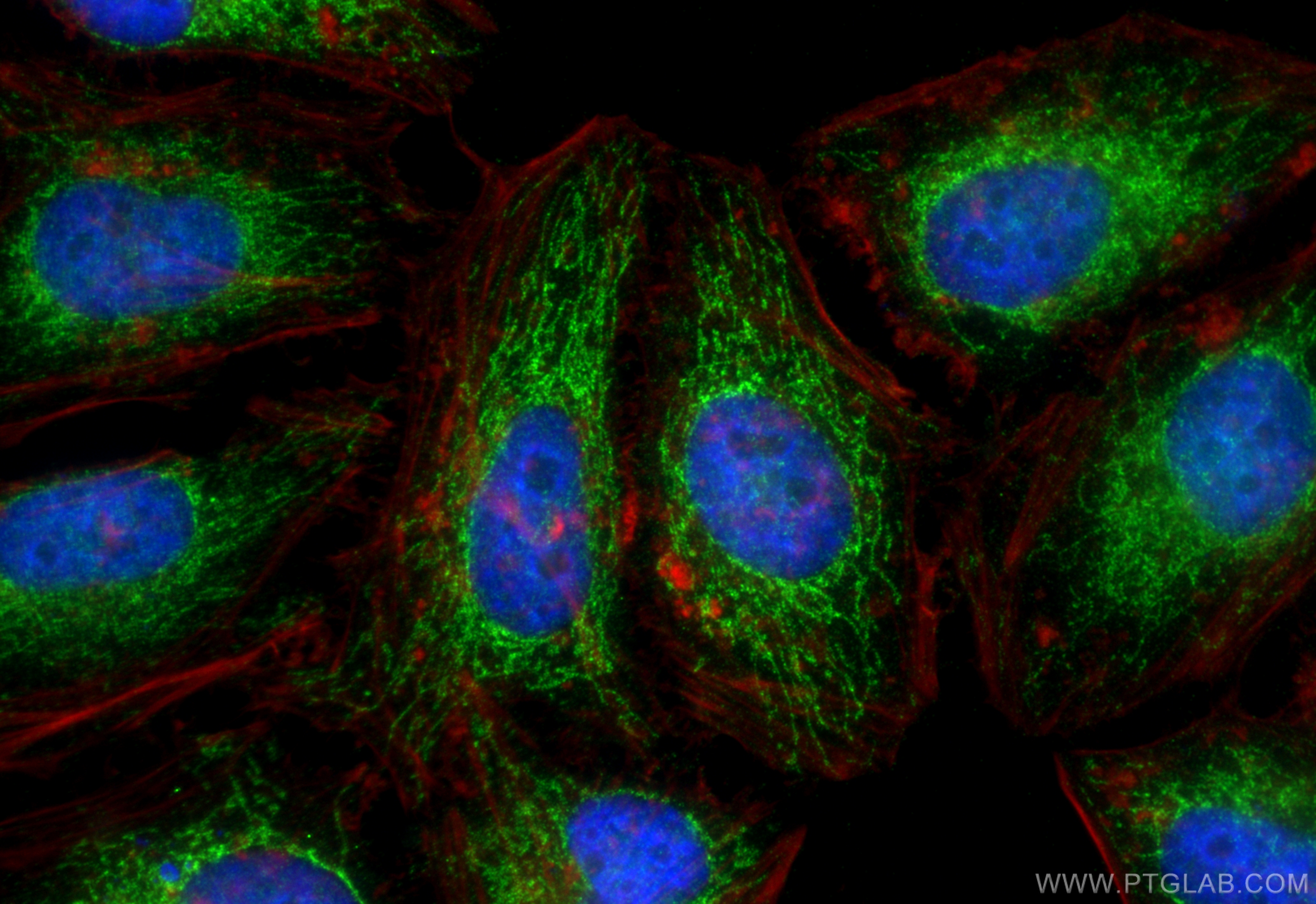 IF Staining of HeLa using 16767-1-AP