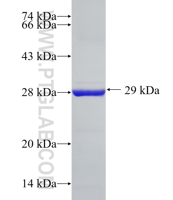 MRPL40 fusion protein Ag10477 SDS-PAGE