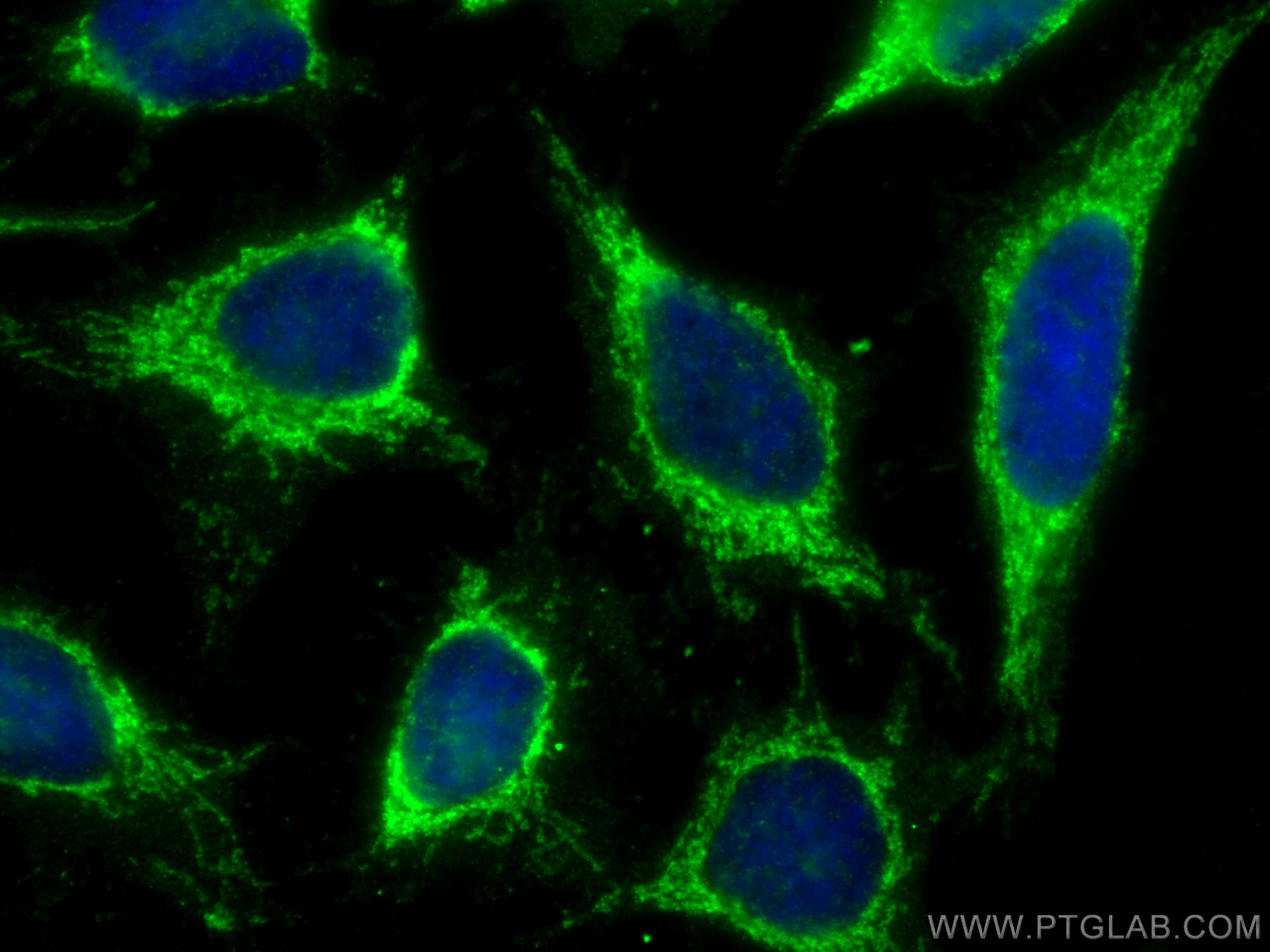 IF Staining of HeLa using 17300-1-AP
