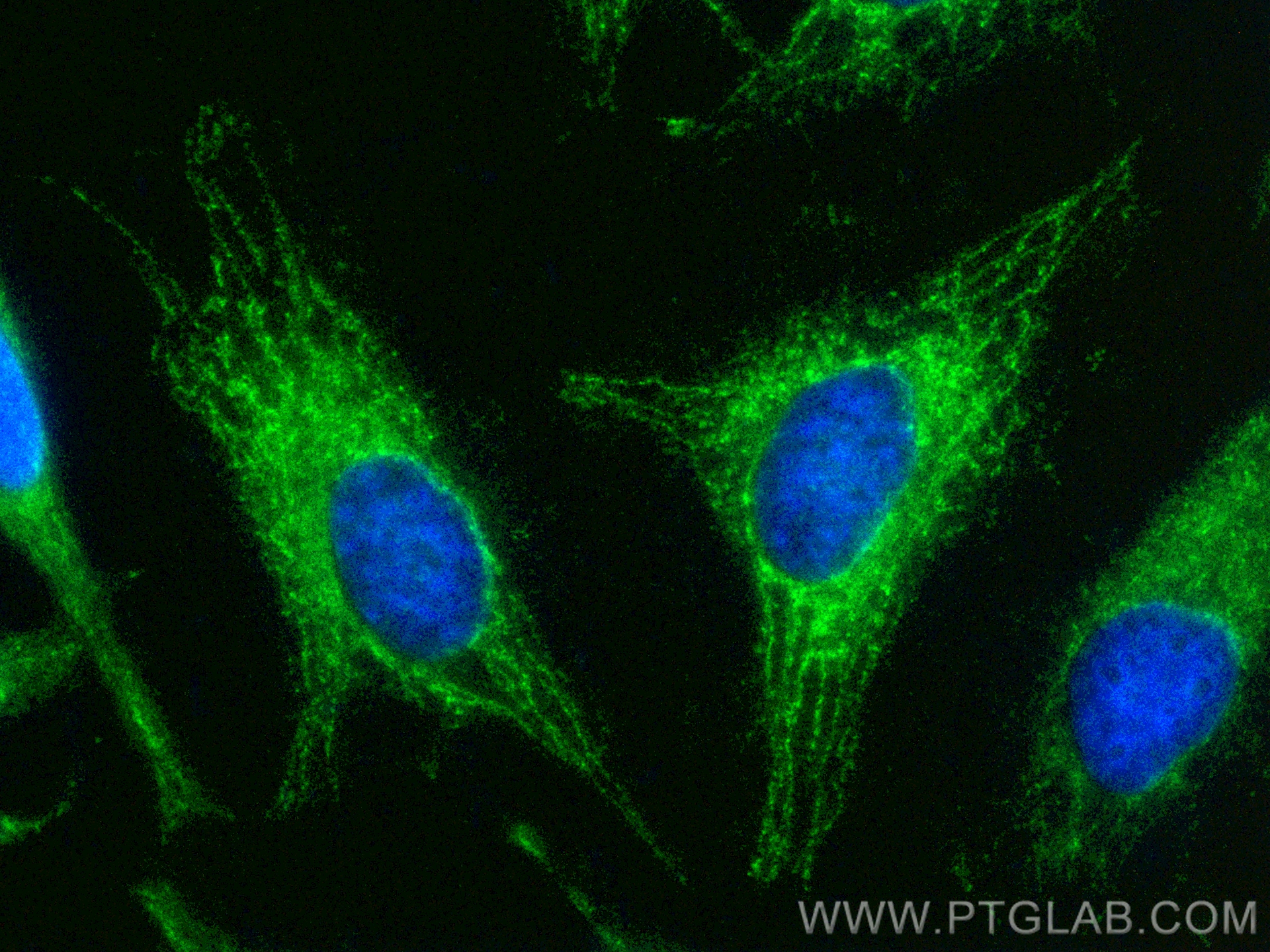 IF Staining of HeLa using CL488-17300