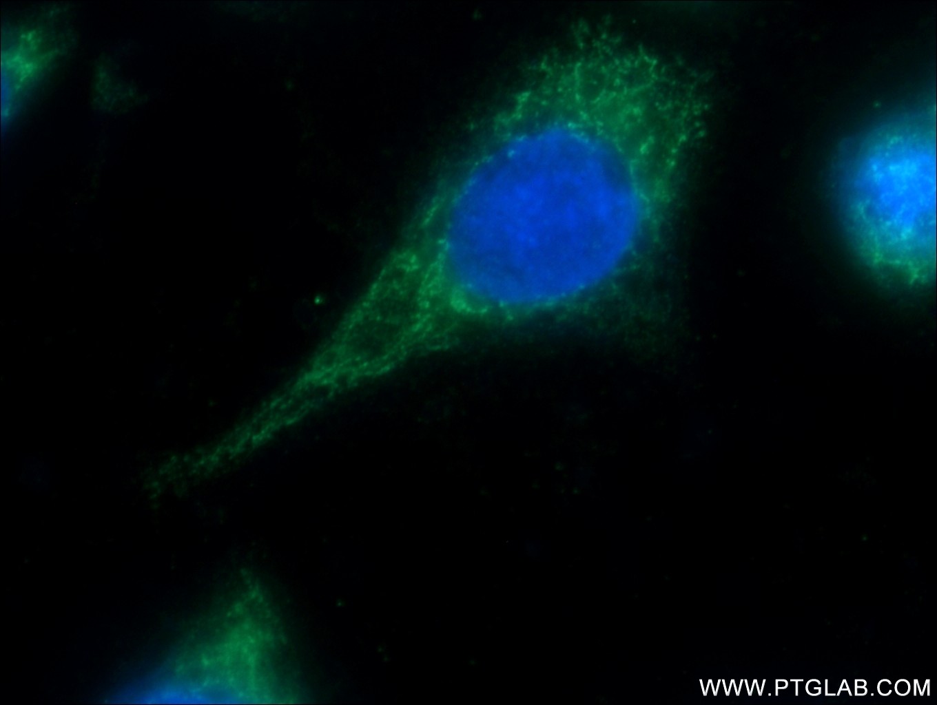 IF Staining of HeLa using 15682-1-AP