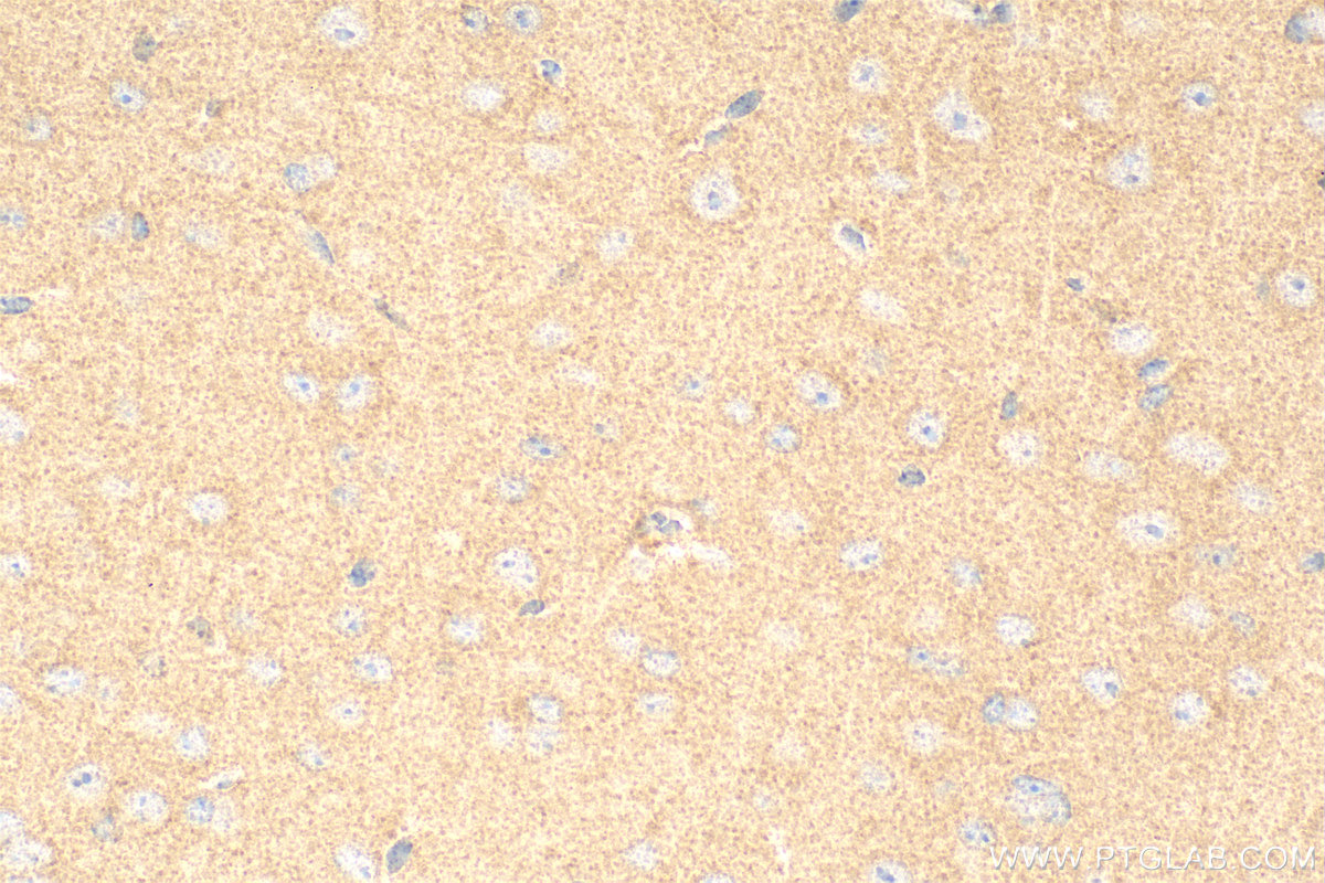 IHC staining of mouse brain using 15682-1-AP
