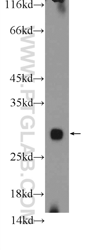 MRPL47 Polyclonal antibody
