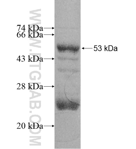MRPL47 fusion protein Ag11085 SDS-PAGE MRPL47 fusion protein Ag11085 SDS-PAGE