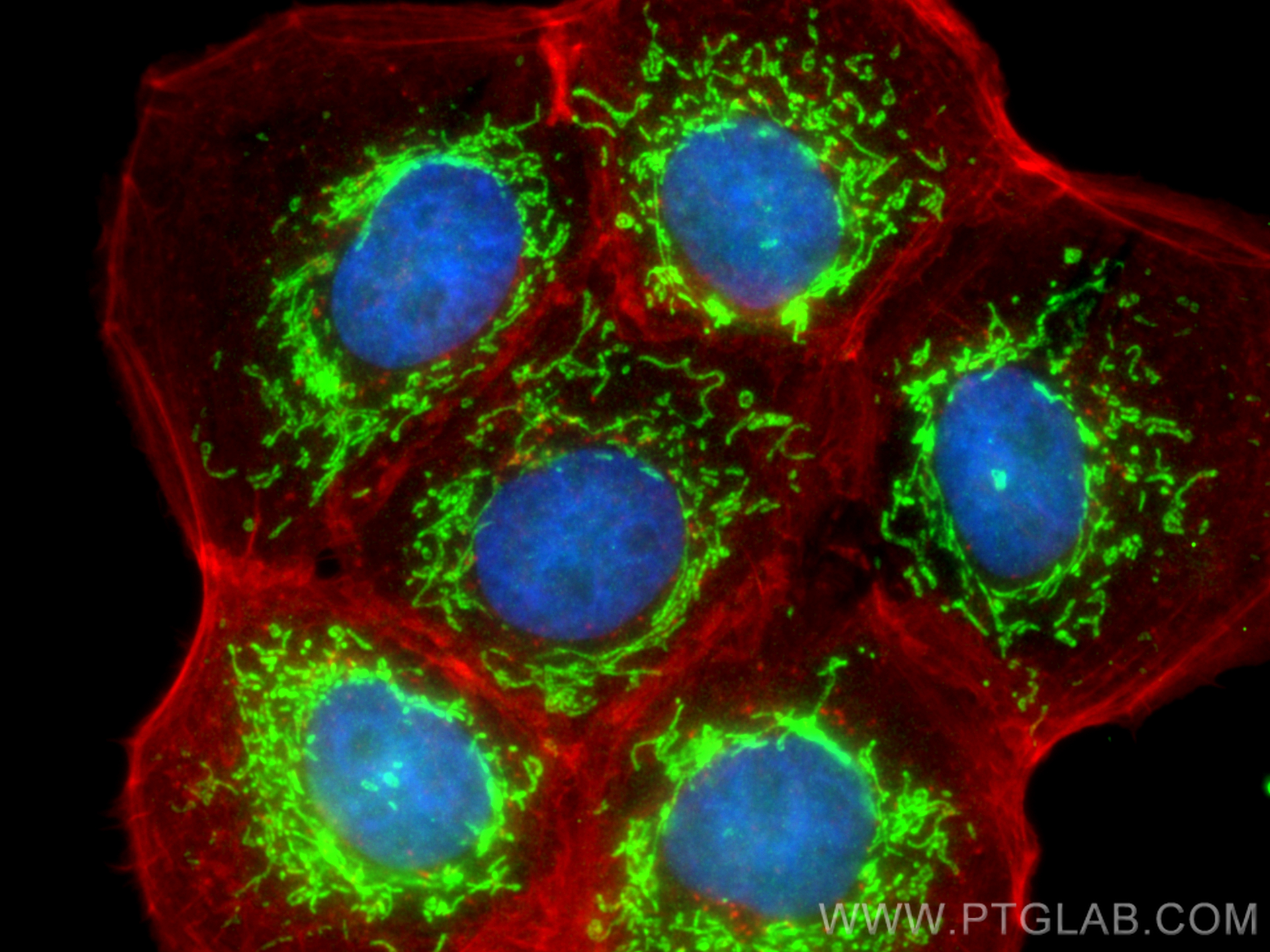 IF Staining of A431 using 14677-1-AP