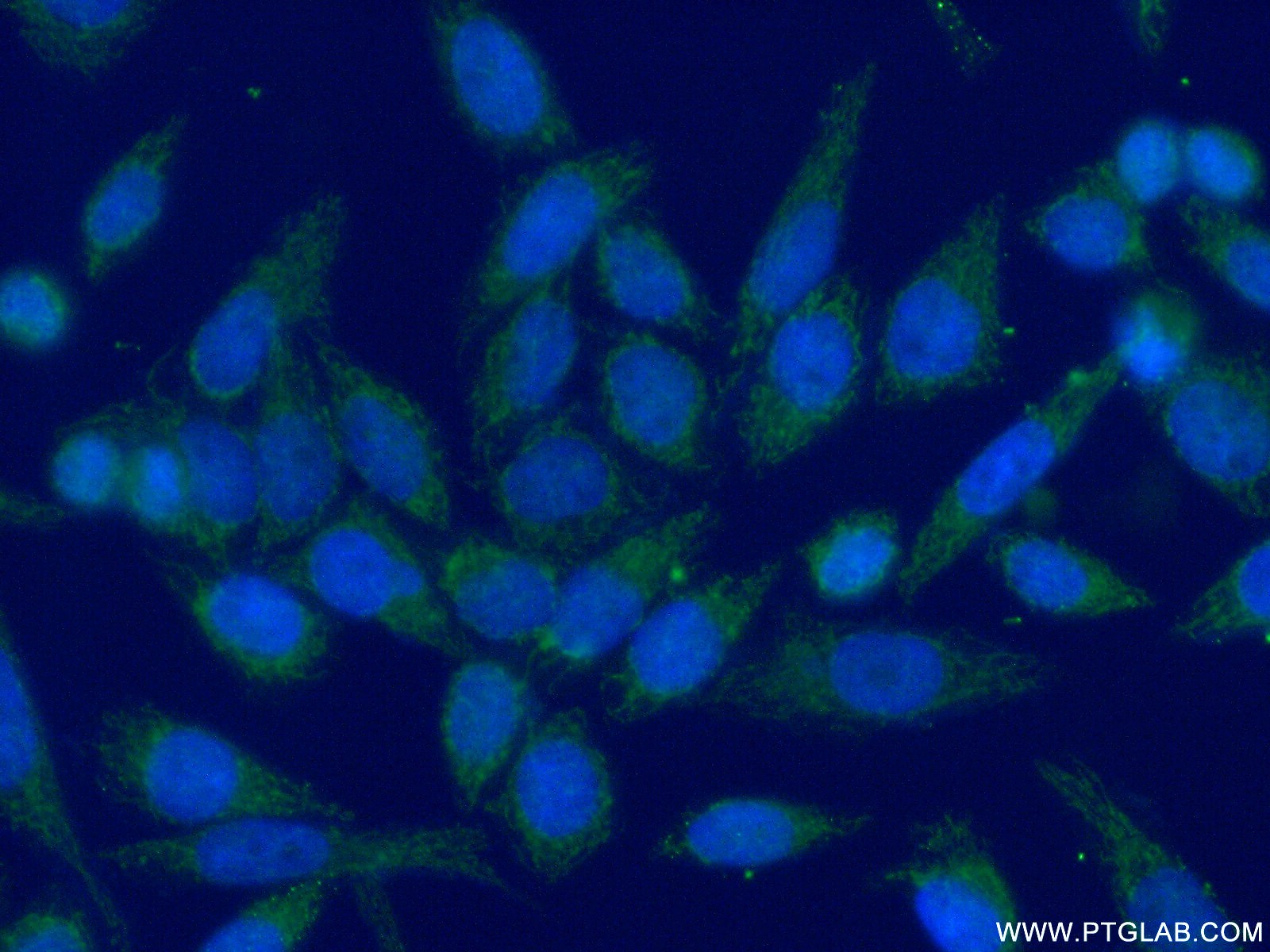 IF Staining of HeLa using 14677-1-AP