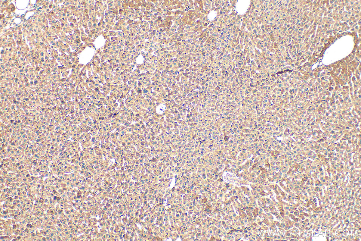 IHC staining of mouse liver using 14677-1-AP