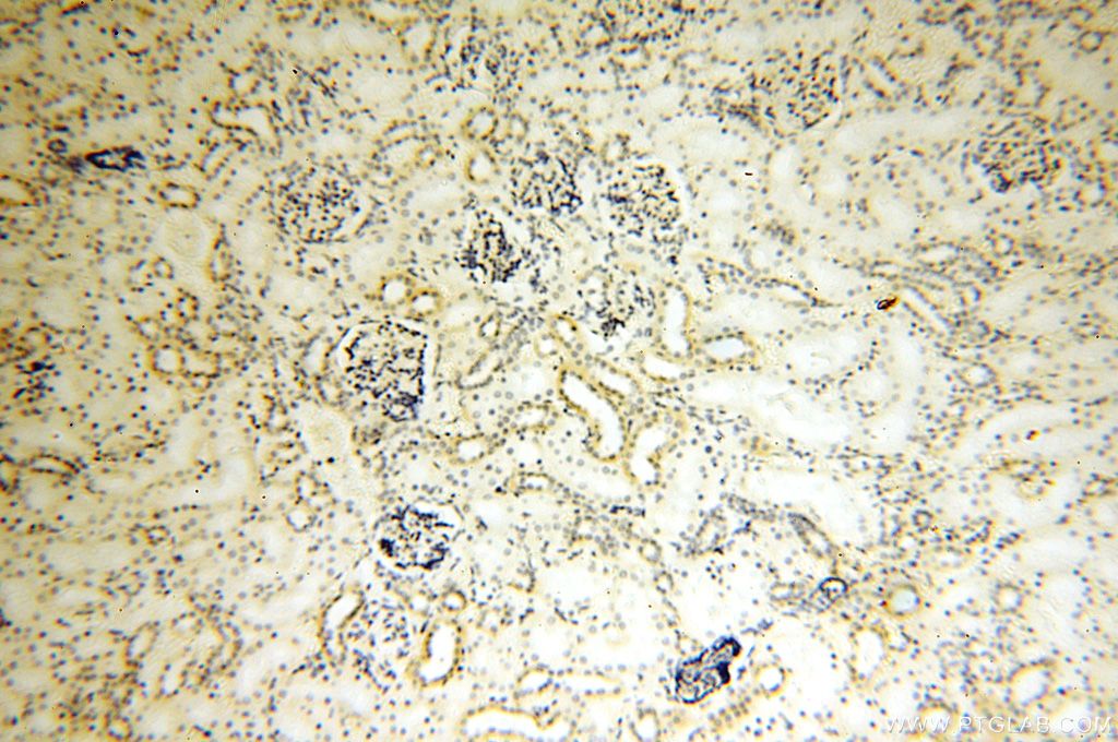 IHC staining of human kidney using 16800-1-AP