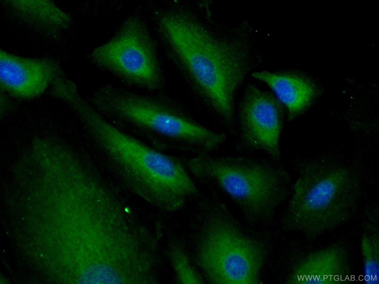 IF Staining of A549 using 16142-1-AP