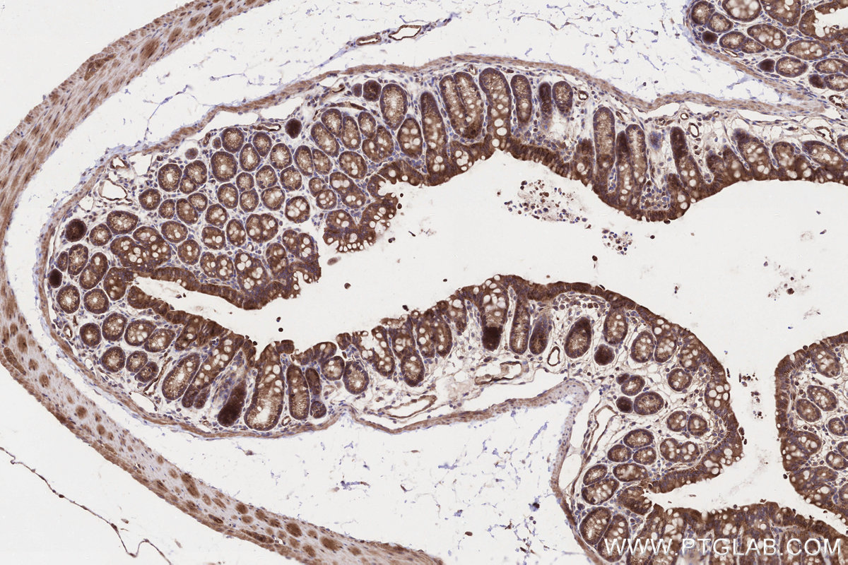 IHC staining of mouse colon using 16142-1-AP IHC staining of mouse colon using 16142-1-AP