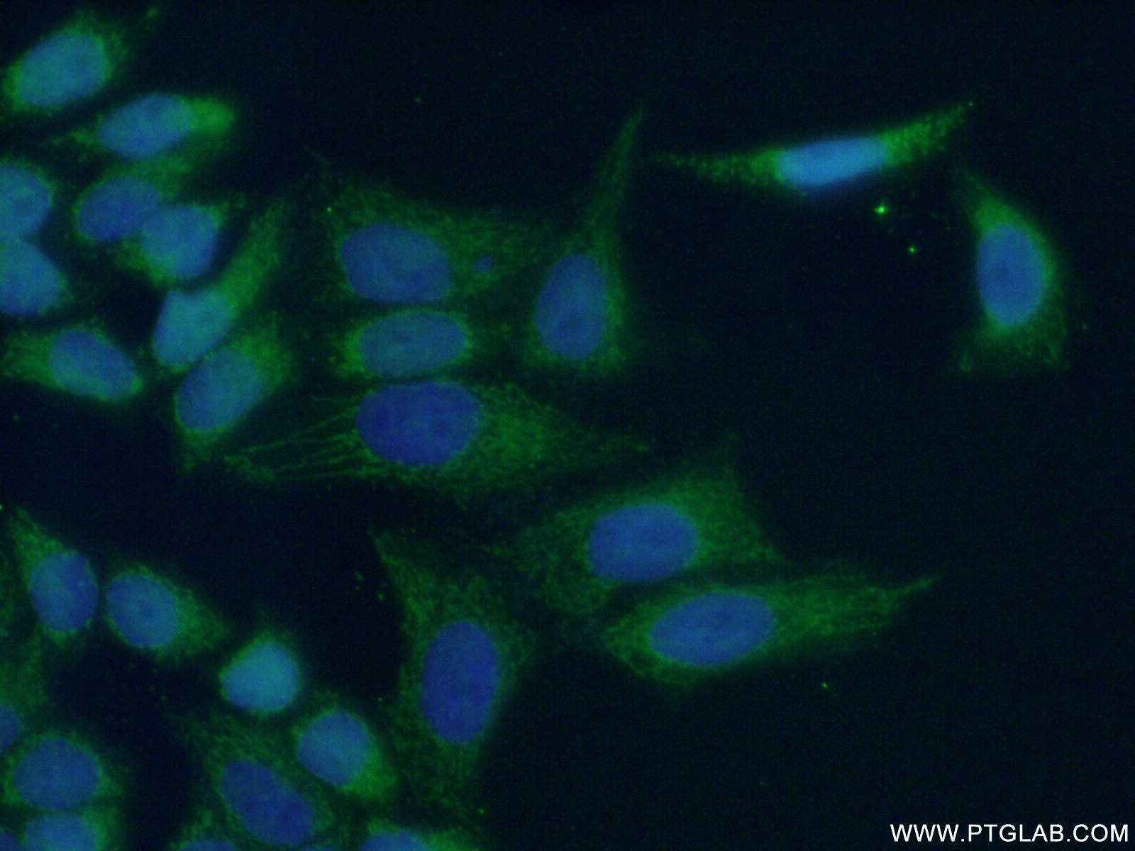 IF Staining of HeLa using 17683-1-AP