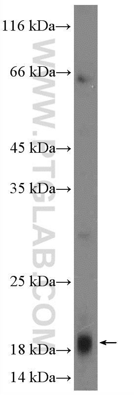 WB analysis of mouse liver using 17683-1-AP