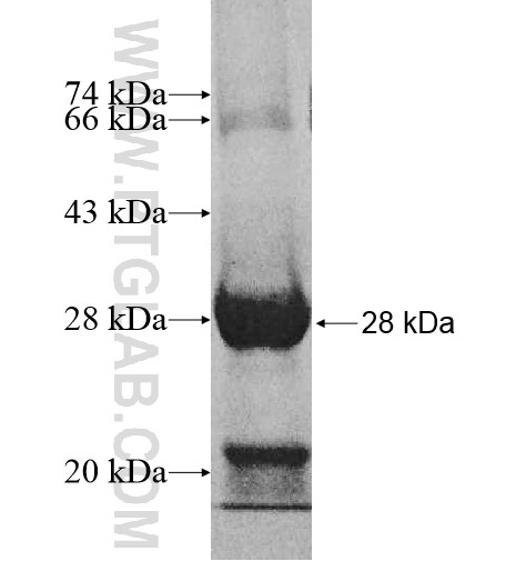 MRPS11 fusion protein Ag10834 SDS-PAGE MRPS11 fusion protein Ag10834 SDS-PAGE