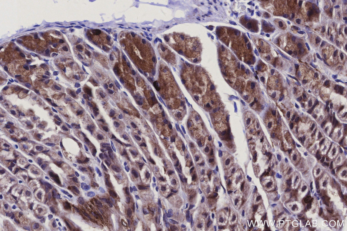 IHC staining of mouse stomach using 16301-1-AP IHC staining of mouse stomach using 16301-1-AP